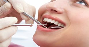 Types and Benefits of Tooth Fillings
