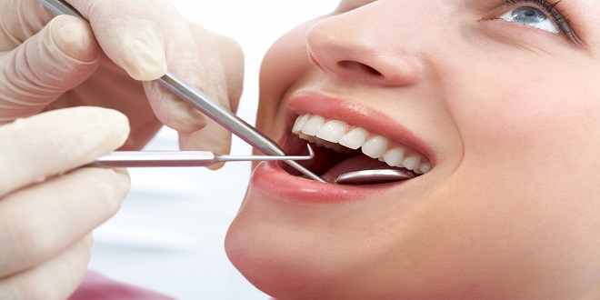Types and Benefits of Tooth Fillings